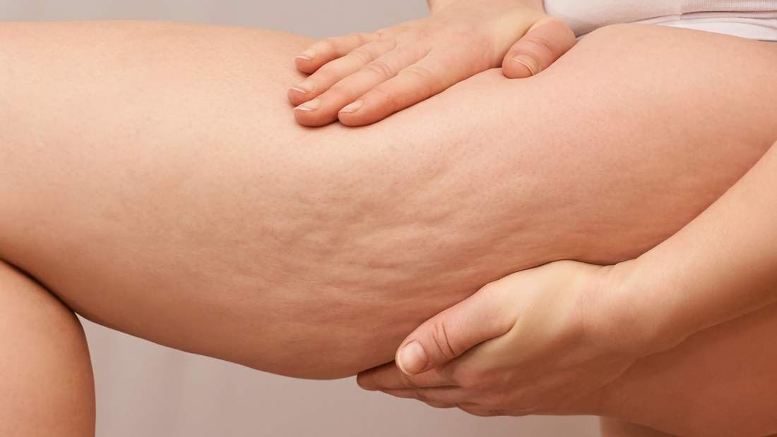 Cellulite natürlich verbessern: Was Trockenbürsten wirklich bringt